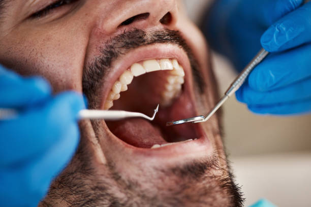 Best Chipped Tooth Repair Near Me  in Altamont, IL
